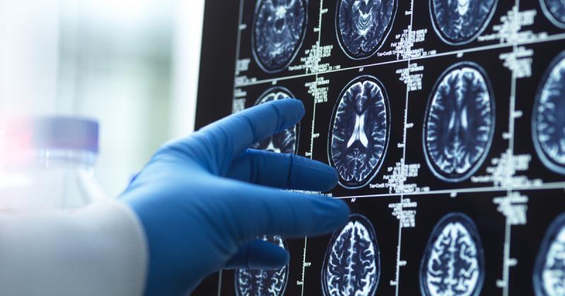 A betegség, amely számos magyart érint, különösen nagyobb kockázattal jár az alábbi anyagok fogyasztásának következtében.